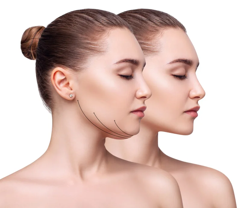 Non-surgical skin tightening facial contours
